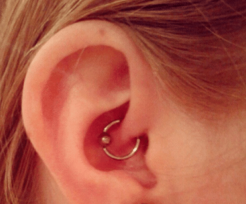 Can Daith Piercing Help Migraines?