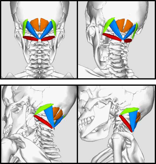 Are Your Suboccipital Muscles Causing You Headaches & Migraines